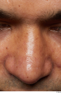 HD Face Skin Henri Sanaky face nose skin pores skin…